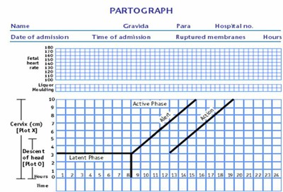 Partogram in Obstetrics Complete Guide for Monitoring Labour Progress - OBSTETRICS AND GYNAECOLOGY